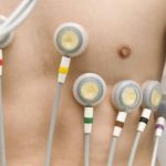 elettrocardiogramma-1920w